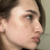 Anokhina Liza Nackt