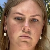 Chynnaclair Nackt