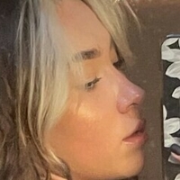 Kiraskys Nackt