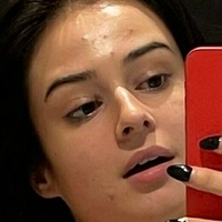 Lauraysergii Nackt