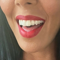 rachelstarrxxx Nackt